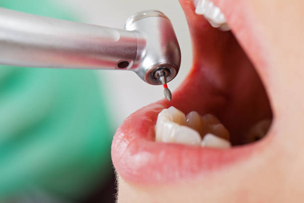 Best Emergency Treatment for Toothache in Rio Hondo, TX
